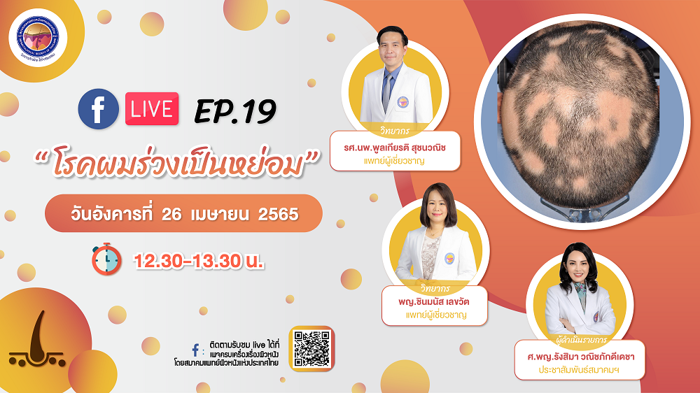 สมาคมแพทย์ผิวหนังฯ เชิญรับชมเพจเฟซบุ๊ก “ครบเครื่องเรื่องผิวหนัง” EP.19 ตอน “โรคผมร่วงเป็นหย่อม”