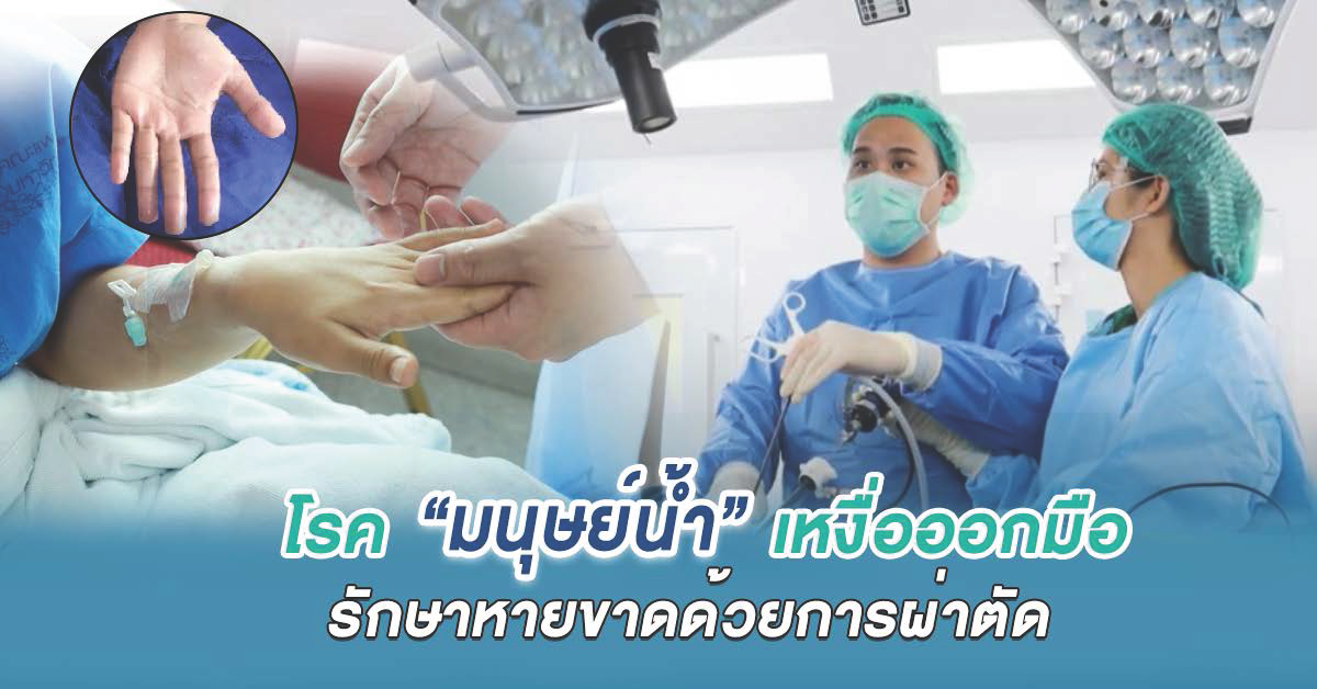 โรค “มนุษย์น้ำ” เหงื่อออกมือรักษาหายขาดด้วยการผ่าตัด