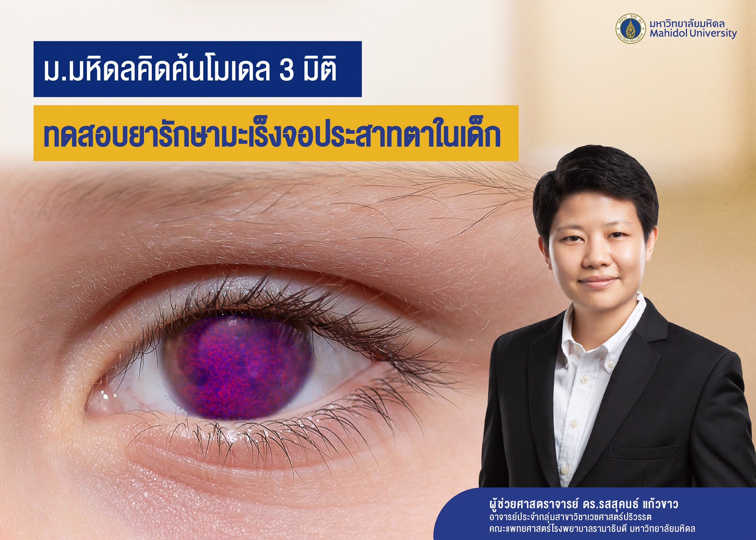 ม.มหิดลคิดค้นโมเดล 3 มิติ ทดสอบยารักษามะเร็งจอประสาทตาในเด็ก