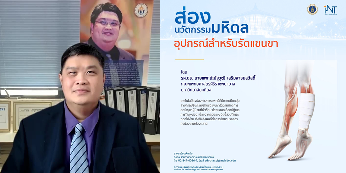 ม.มหิดล คืนรอยยิ้มให้ผู้ป่วยหลอดเลือดดำขอดไทย สร้างสรรค์นวัตกรรม 