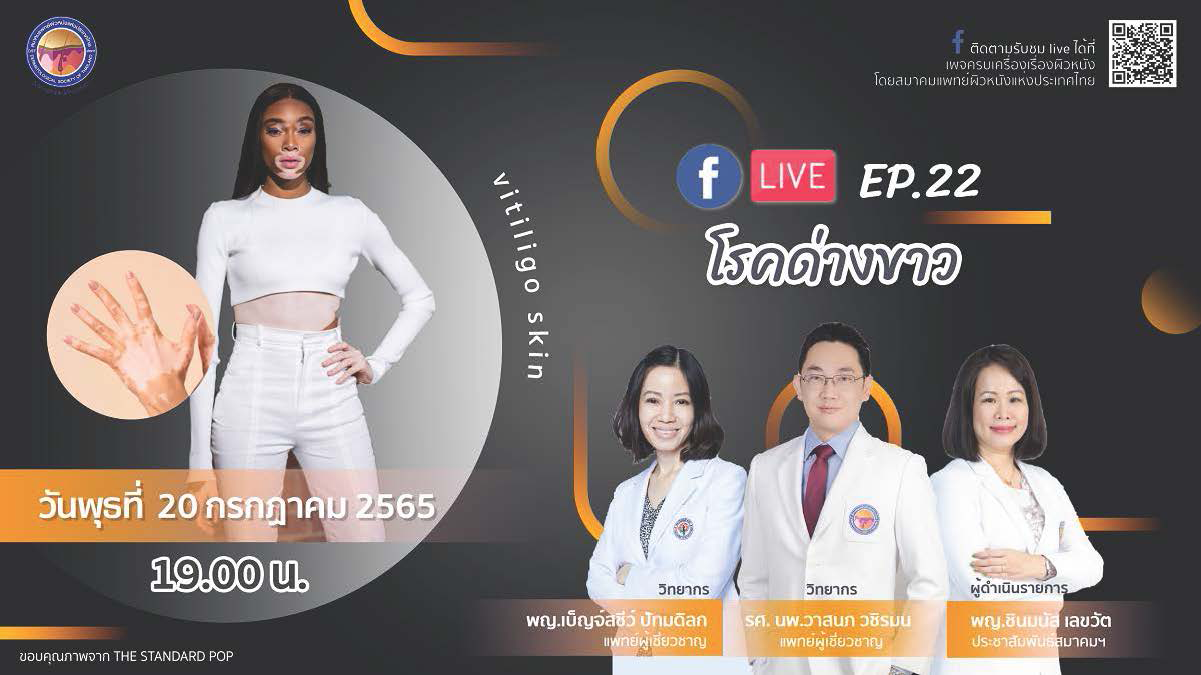 สมาคมแพทย์ผิวหนังฯ เชิญรับชมเพจเฟซบุ๊ก “ครบเครื่องเรื่องผิวหนัง”EP.22 ตอน “โรคด่างขาว”