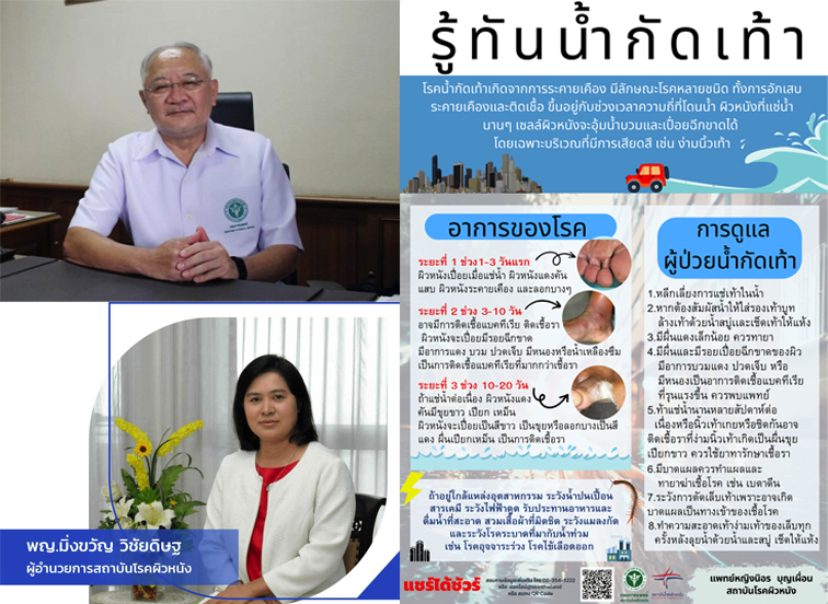 แพทย์ผิวหนังแนะนำการดูแลโรคน้ำกัดเท้า
