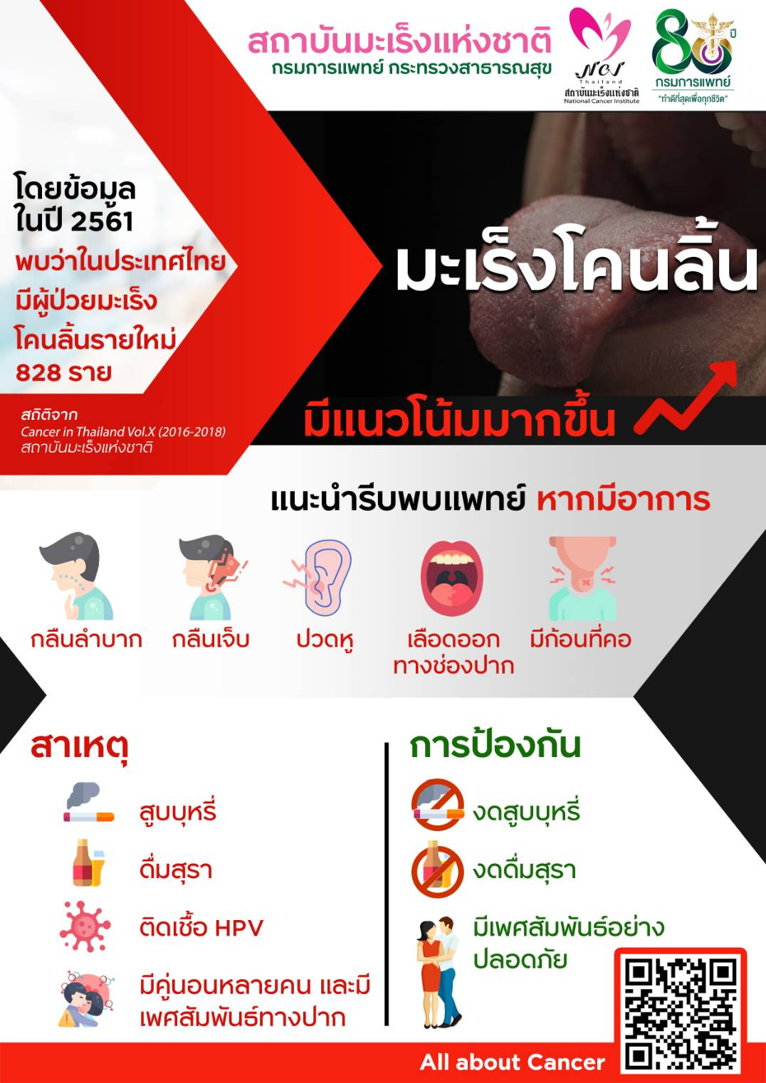 รู้จัก “มะเร็งโคนลิ้น” โรคร้ายที่พบได้ไม่บ่อยในคนไทย