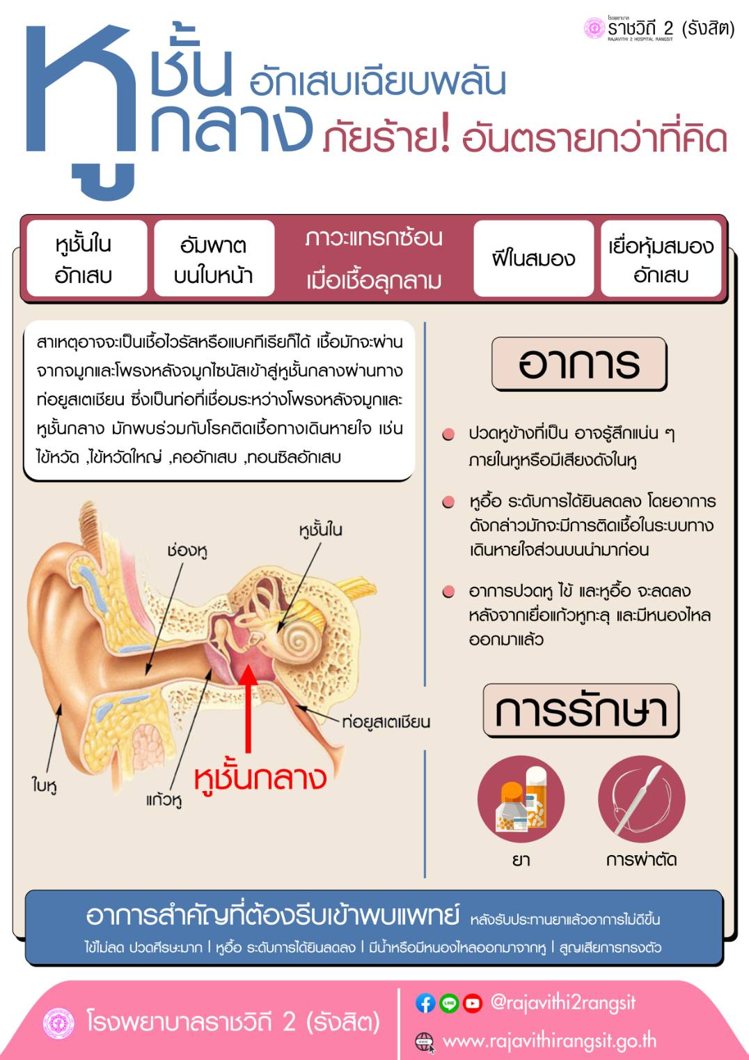 หูชั้นกลางอักเสบเฉียบพลัน ภัยร้ายอันตรายกว่าที่คิด