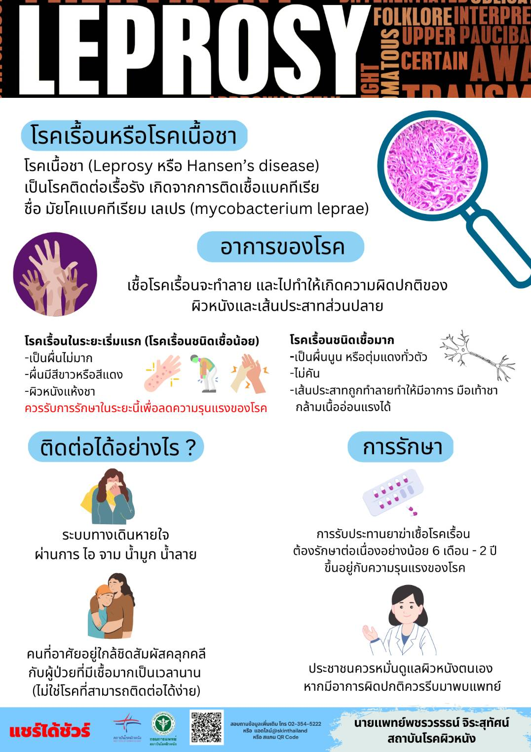 โรคเรื้อนหรือโรคเนื้อชาเป็นแล้วรักษาหายขาดได้
