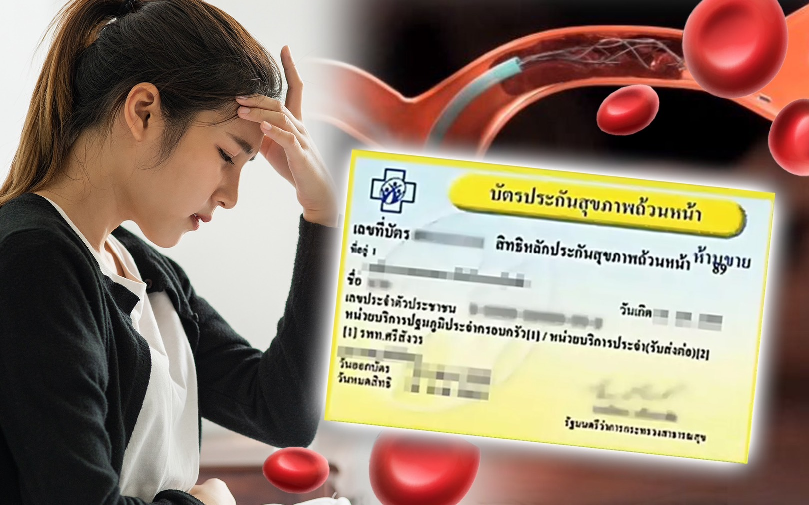 คนไทยเฮ บัตรทองเพิ่มสิทธิการรักษาหลอดเลือดอุดตันด้วยสายสวนหลอดเลือดผลจากวิจัย “ประเมินความคุ้มค่า” สู่การพัฒนาคุณภาพชีวิตของผู้ป่วย 