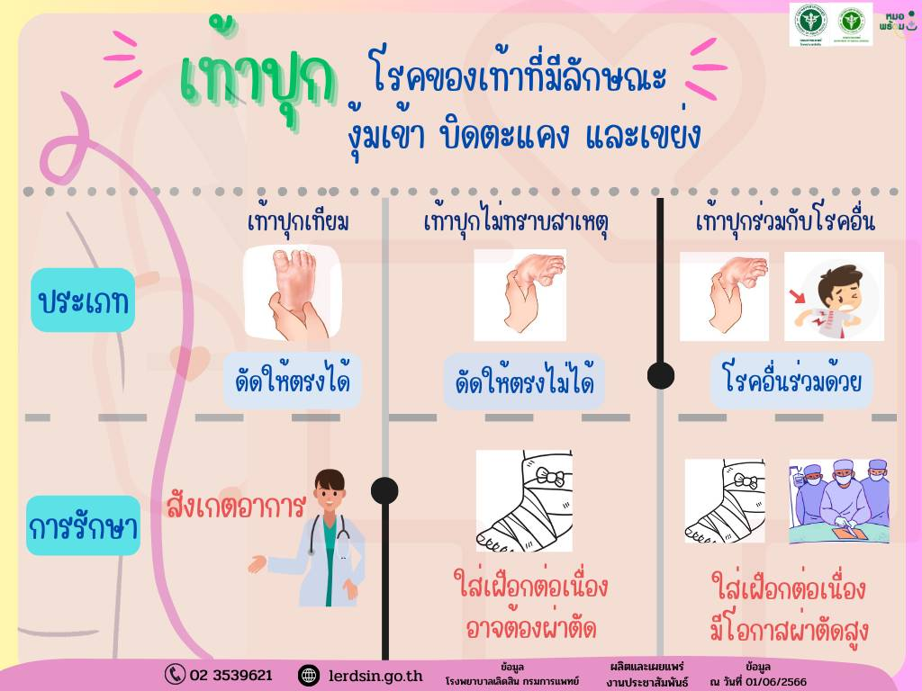 โรงพยาบาลเลิดสิน กรมการแพทย์ แจงประเภทเท้าปุก ควรมาพบแพทย์เร็วที่สุด