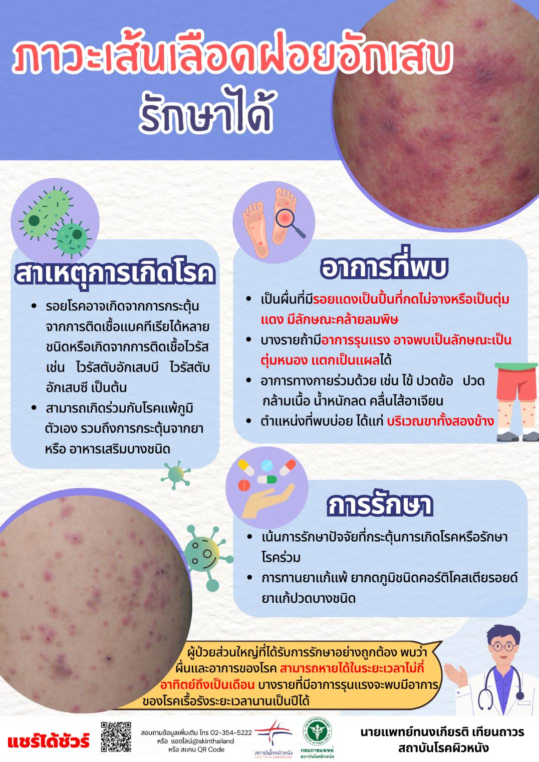 แพทย์ผิวหนังชี้ภาวะเส้นเลือดฝอยอักเสบรักษาได้