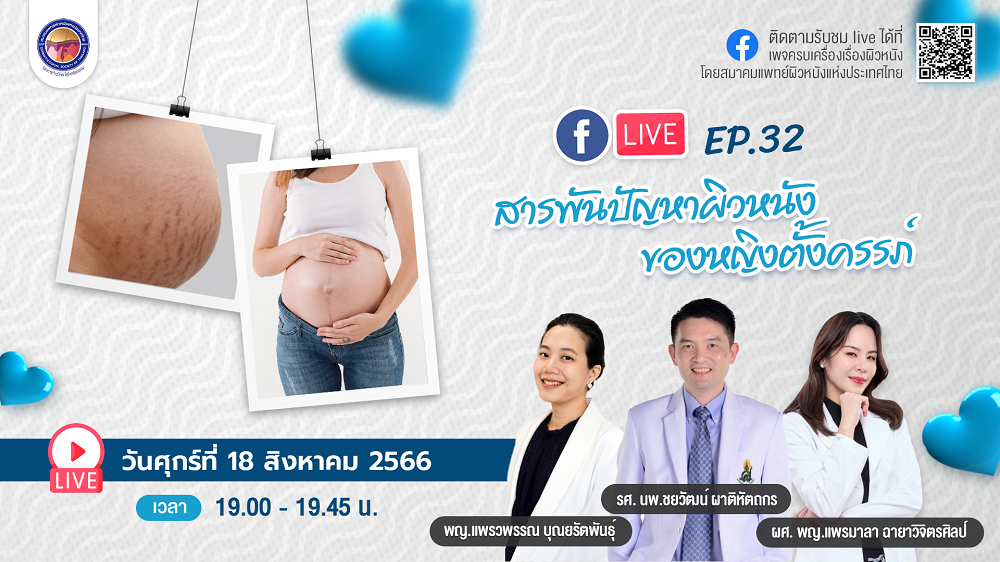 สมาคมแพทย์ผิวหนังฯ เชิญรับชมเพจเฟซบุ๊ก “ครบเครื่องเรื่องผิวหนัง” EP.32 ตอน “สารพันปัญหาผิวหนังของหญิงตั้งครรภ์”