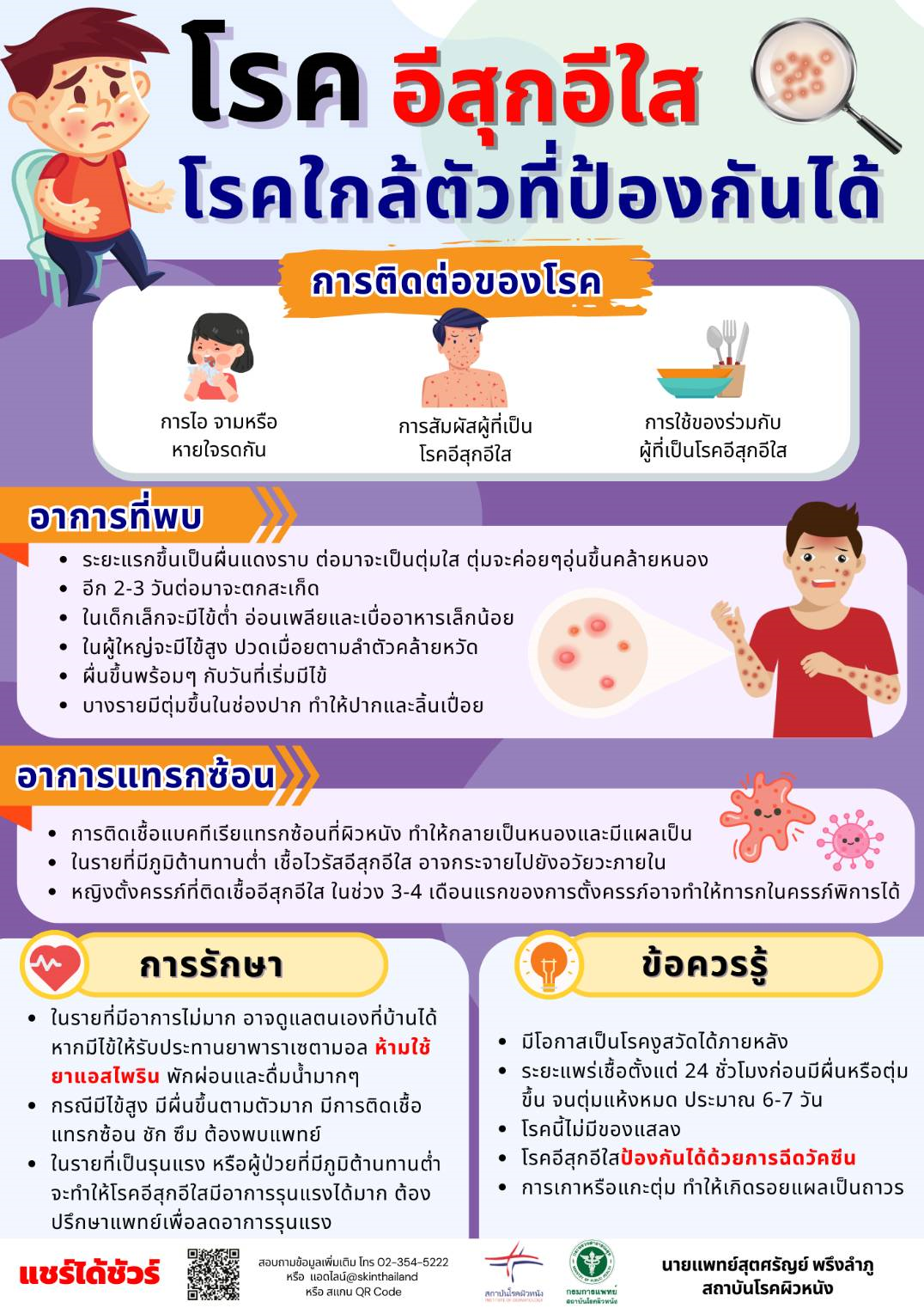 โรคอีสุกอีใส โรคใกล้ตัวที่ป้องกันได้