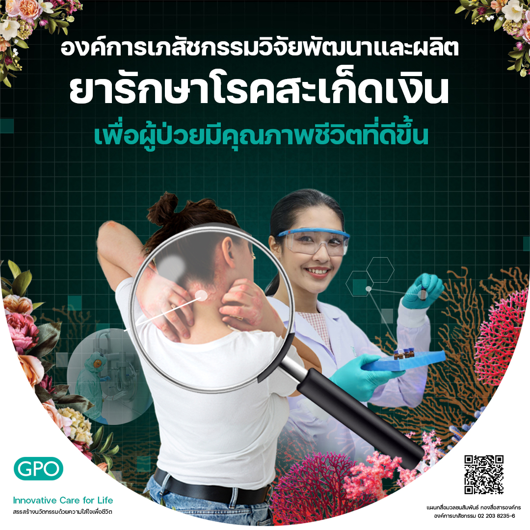 องค์การเภสัชกรรมวิจัยพัฒนาและผลิตยารักษาโรคสะเก็ดเงิน เพื่อผู้ป่วยมีคุณภาพชีวิตที่ดีขึ้น 