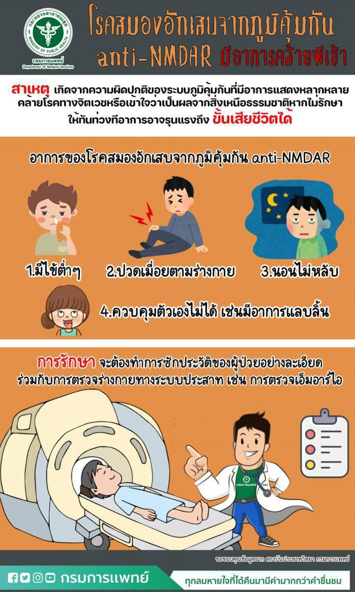 สถาบันประสาทวิทยาเผยโรคสมองอักเสบจากภูมิคุ้มกัน anti-NMDAR มีอาการคล้ายผีเข้า