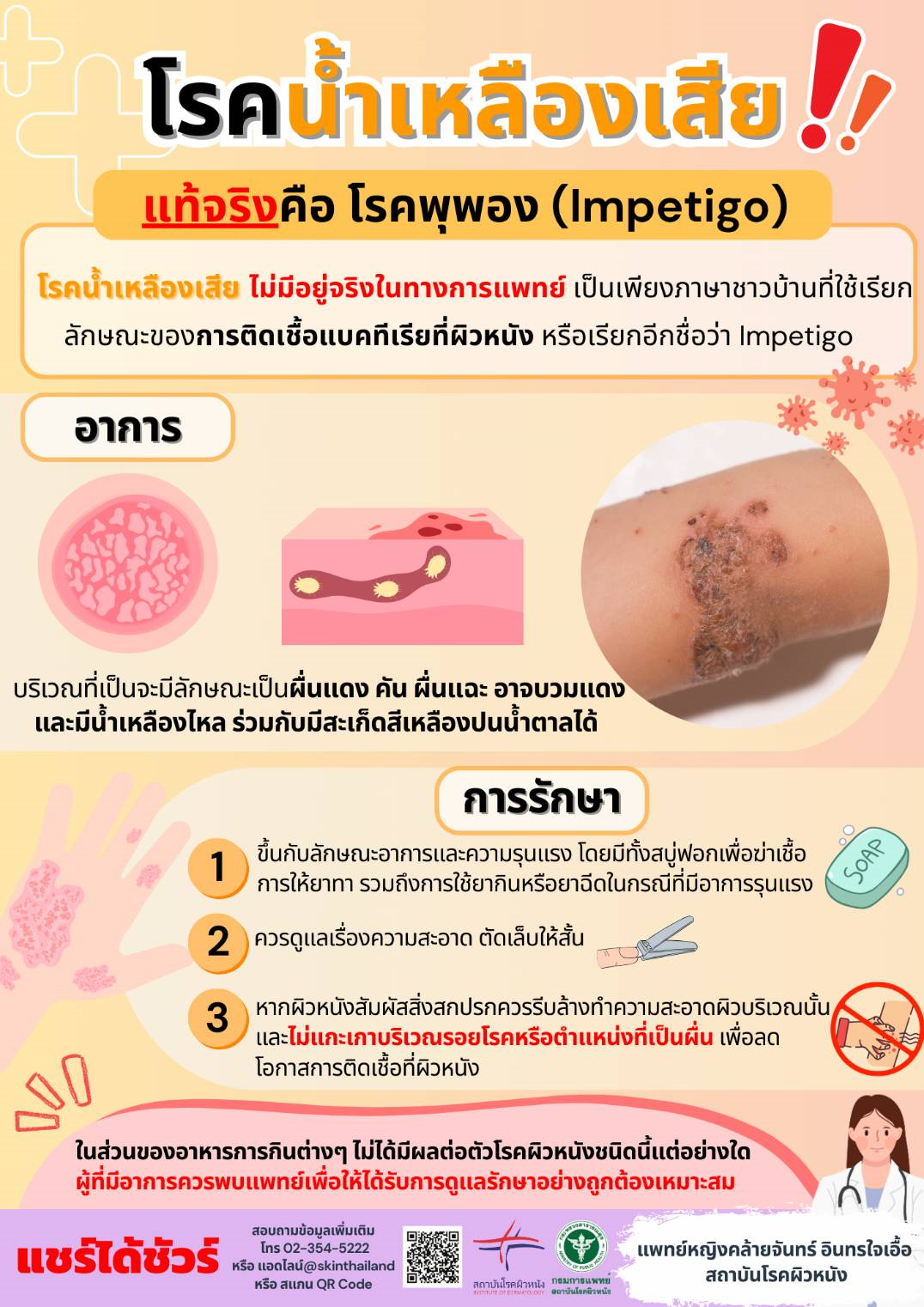 โรคน้ำเหลืองเสีย มีอยู่จริงหรือไม่