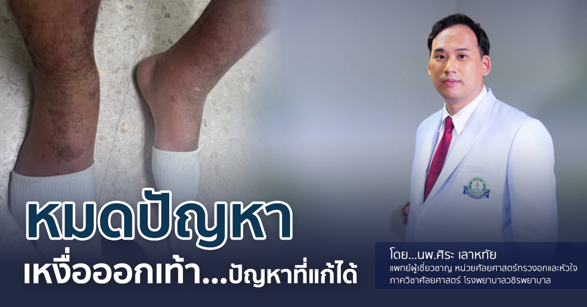 หมดปัญหาเหงื่อออกเท้า ปัญหาที่แก้ได้