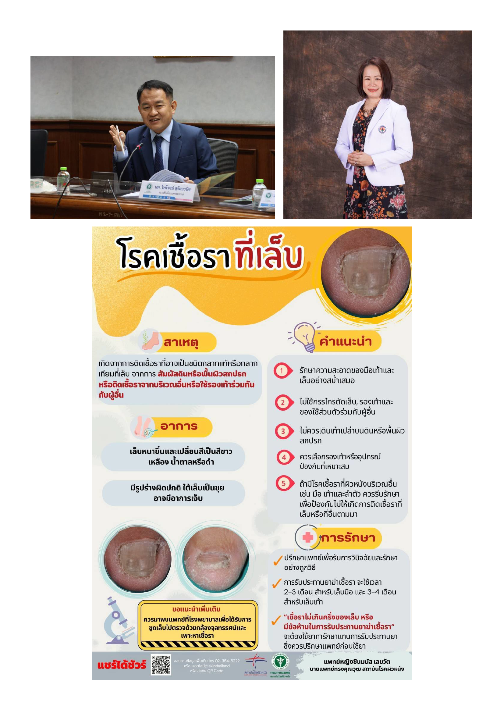 อันตรายจากโรคเชื้อราที่เล็บ