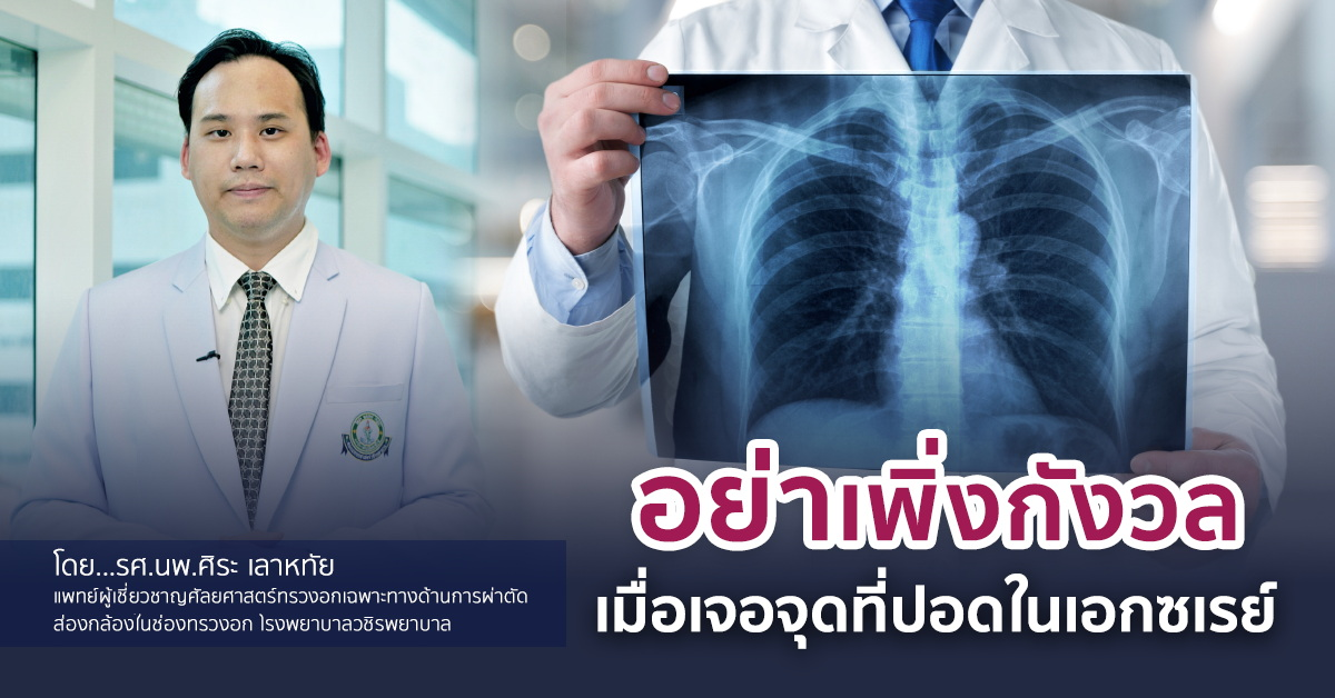 อย่าเพิ่งกังวลเมื่อเจอจุดที่ปอดในเอกซเรย์