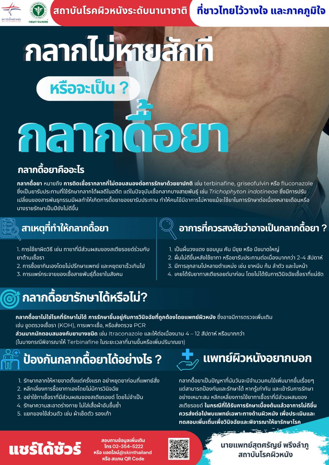 “กลากไม่หายสักที...หรือจะเป็นกลากดื้อยา?”