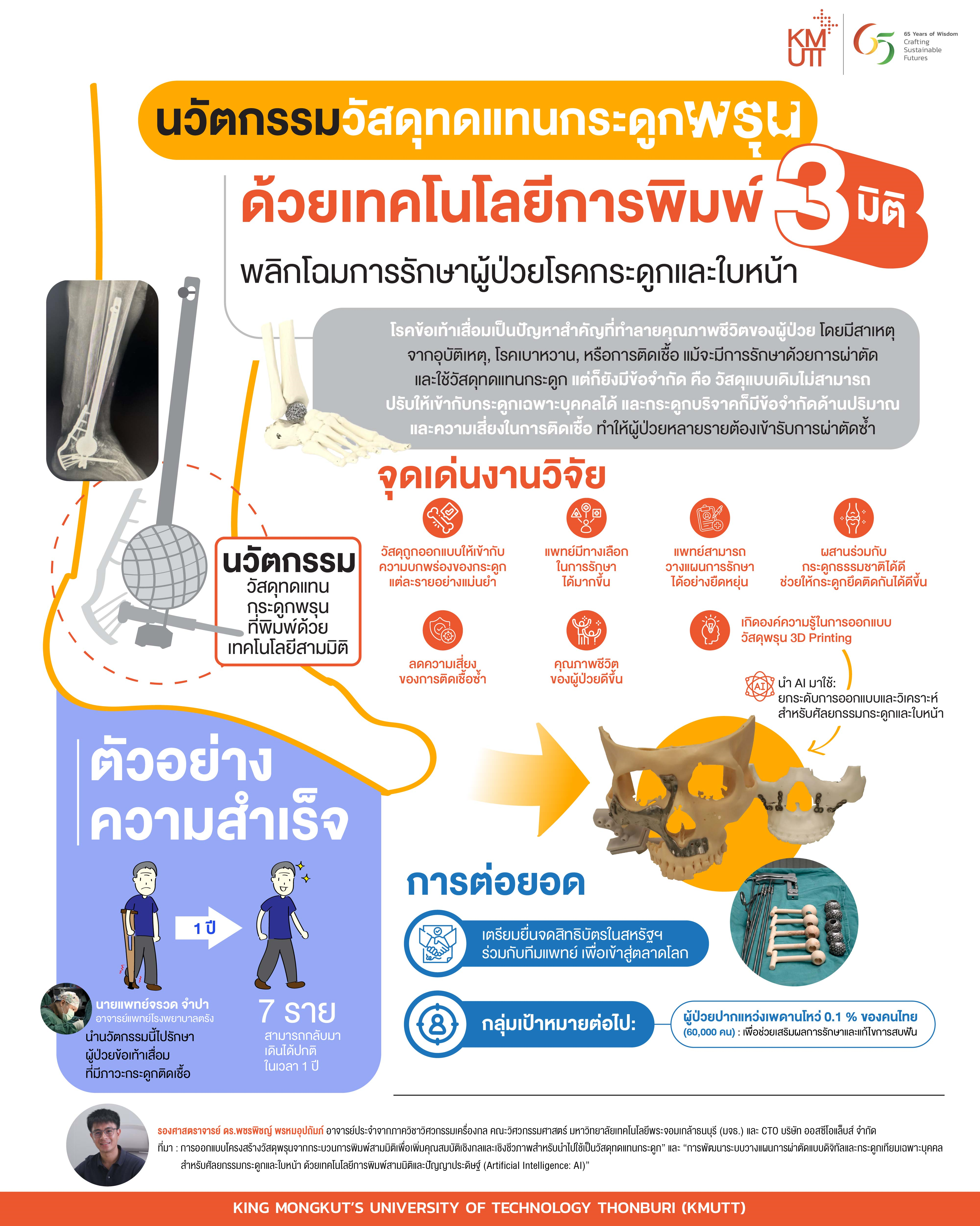 นวัตกรรมวัสดุทดแทนกระดูกพรุนด้วยเทคโนโลยีการพิมพ์สามมิติ’ “พลิกโฉมการรักษาผู้ป่วยโรคกระดูกและการศัลยกรรมขากรรไกร  โดยมจธ.