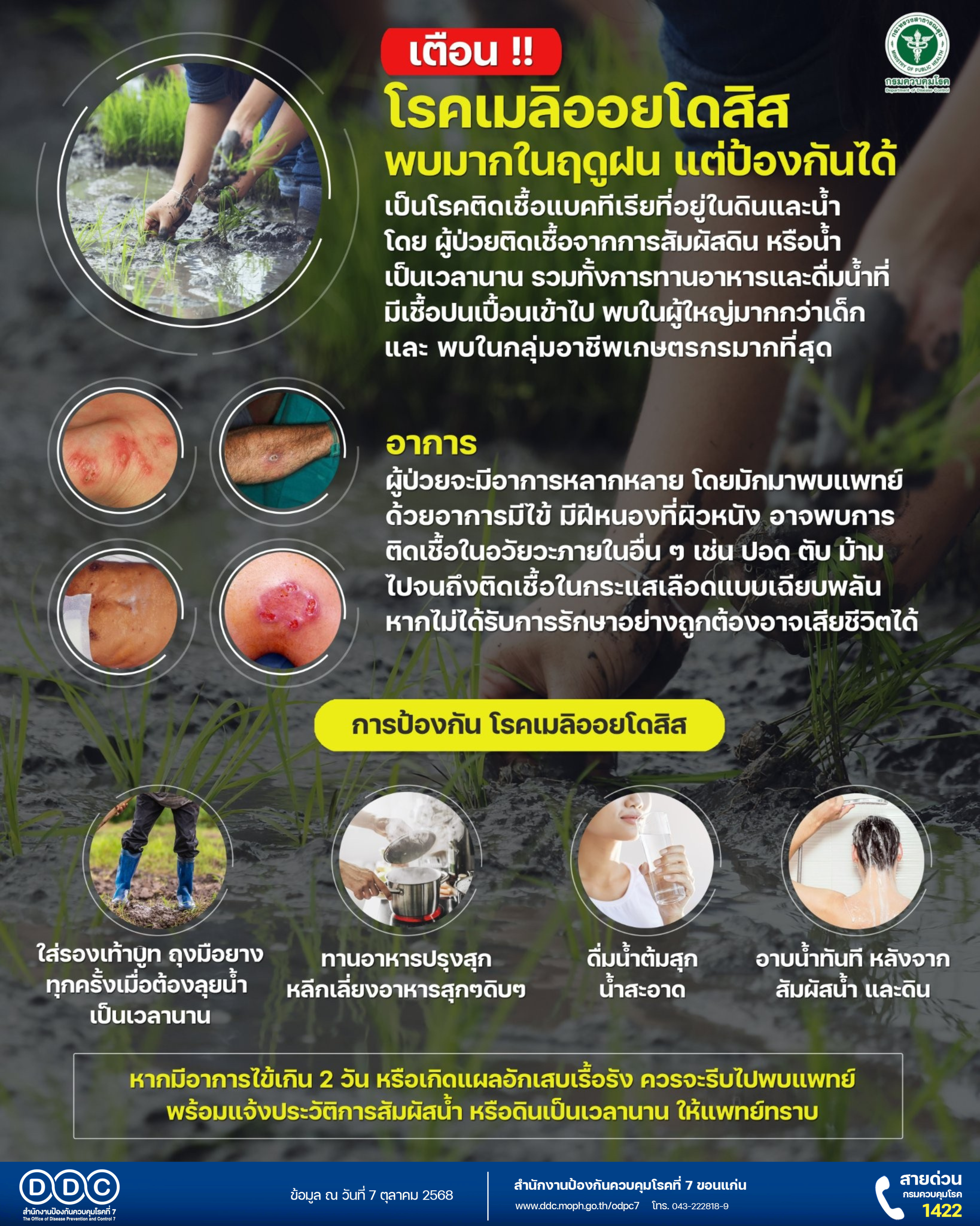 สคร.7 เตือนผู้ป่วยเบาหวาน-ผู้มีบาดแผล หลีกเลี่ยงสัมผัสน้ำ และดินโคลน ย้ำโรคเมลิออยด์ต้นเหตุติดเชื้อป่วยมีอาการรุนแรง