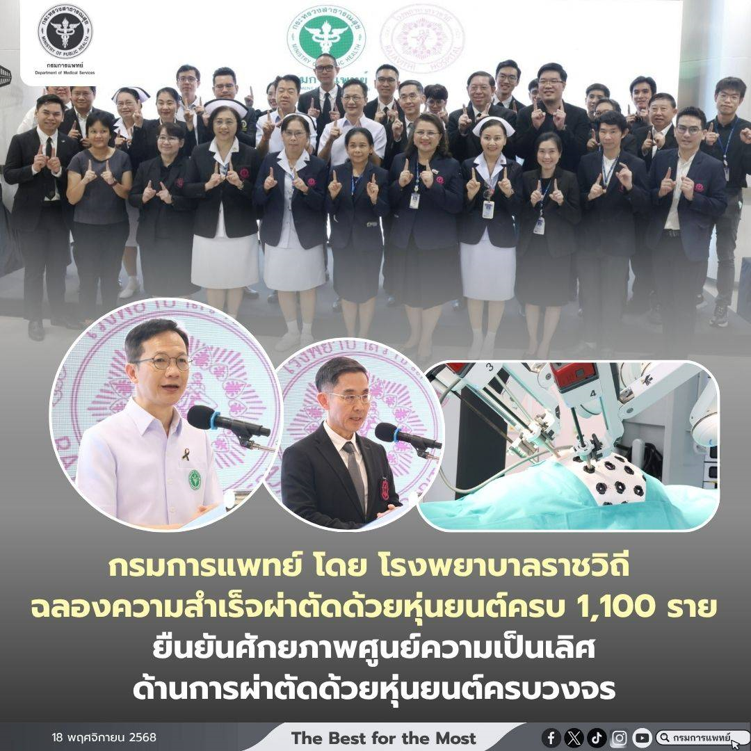 โรงพยาบาลราชวิถี กรมการแพทย์ ฉลองความสำเร็จผ่าตัดด้วยหุ่นยนต์ครบ 1,100 ราย ยืนยันศักยภาพศูนย์ความเป็นเลิศด้านการผ่าตัดด้วยหุ่นยนต์ครบวงจร