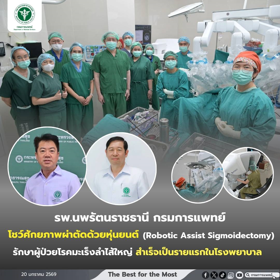 โรงพยาบาลนพรัตนราชธานีโชว์ศักยภาพผ่าตัดด้วยหุ่นยนต์ (Robotic Assist Sigmoidectomy) รักษาผู้ป่วยโรคมะเร็งลำไส้ใหญ่ (Sigmoid Colon Cancer) สำเร็จเป็นรายแรกในโรงพยาบาล